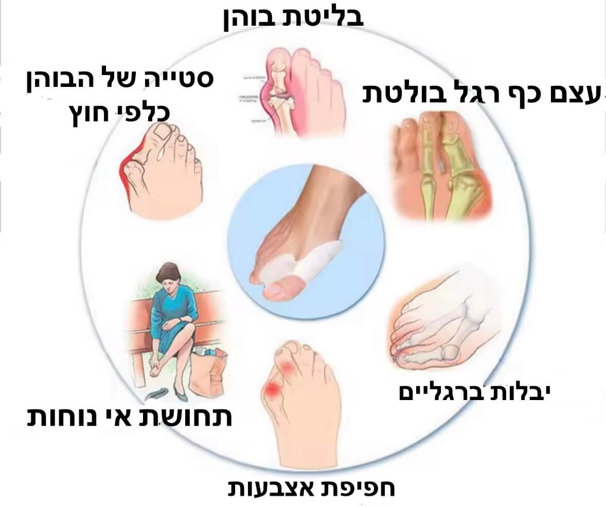 מיישר בוהן סיליקון