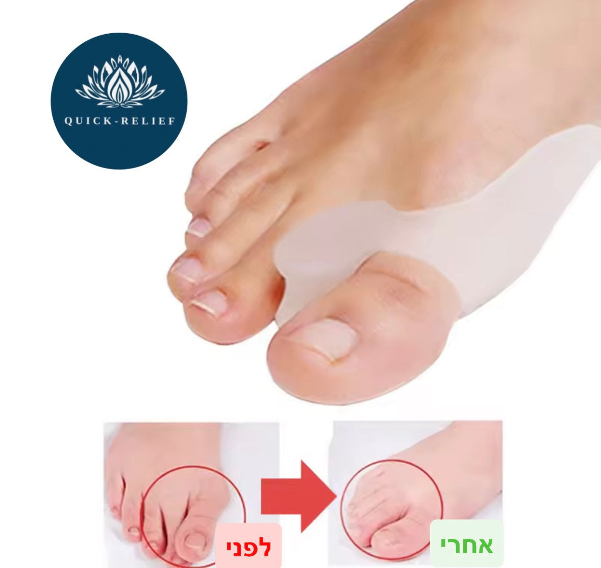 מיישר בוהן סיליקון