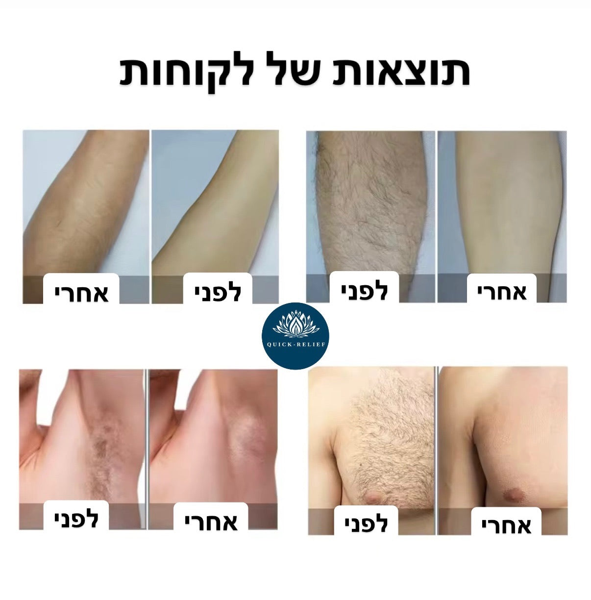 תוצאות של לקוחות- תמונות לפני ואחרי