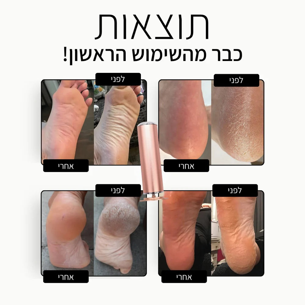 מכשיר פדיקור מניקור