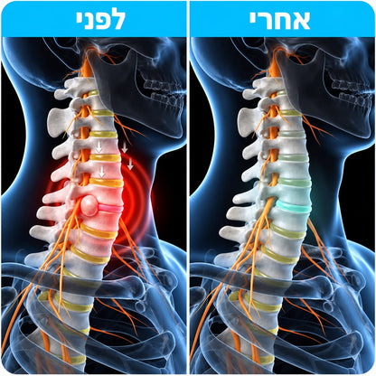 מרפה הצוואר